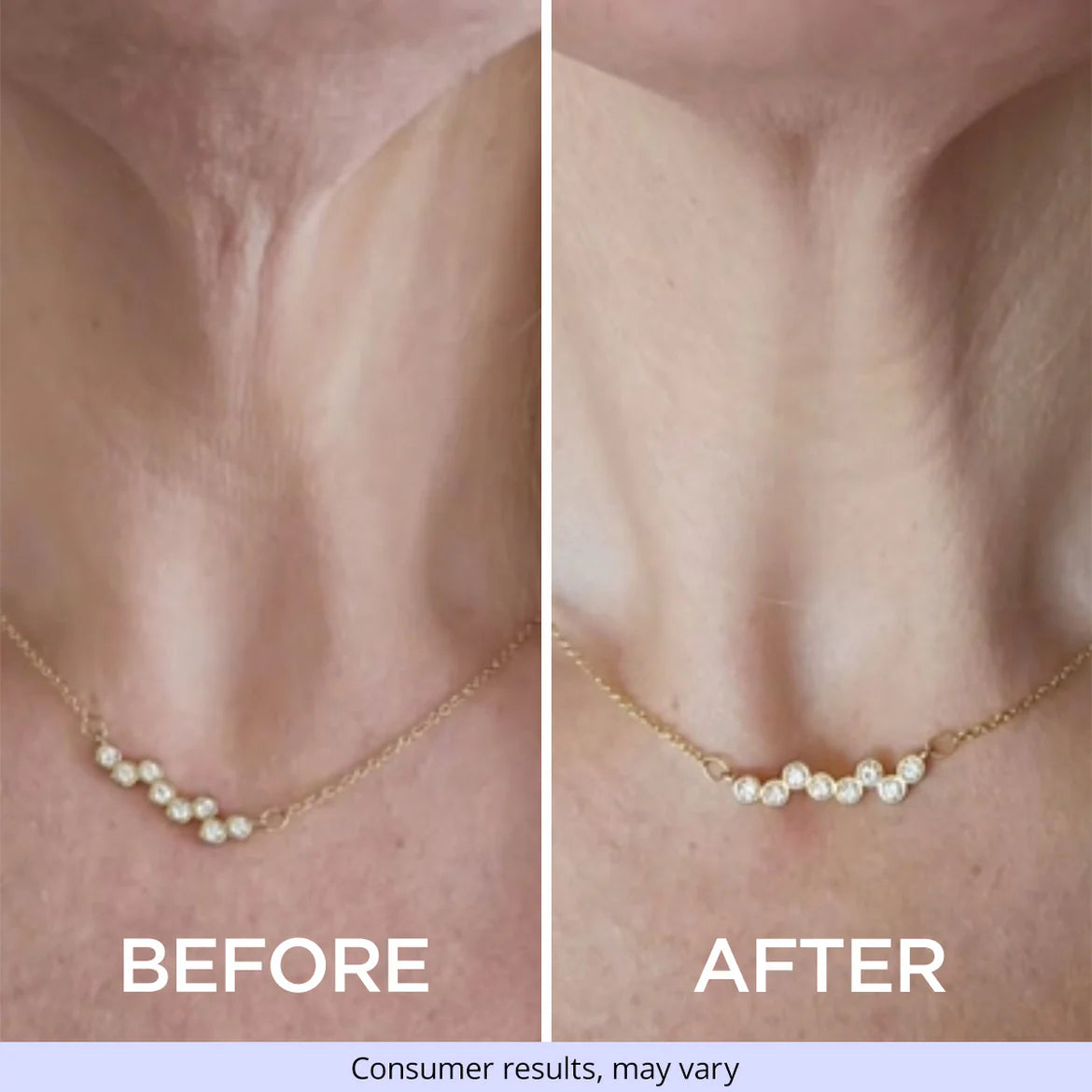 Tighten & Lift Neck Cream | REVOSKIN