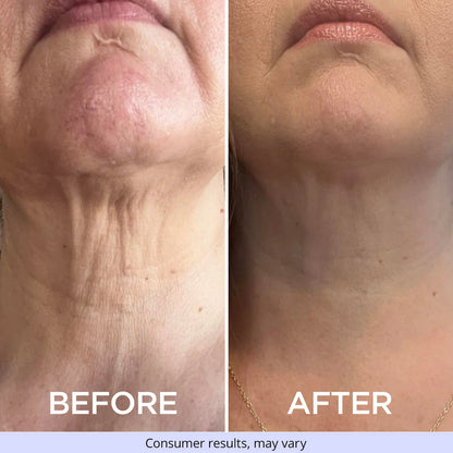 Tighten & Lift Neck Cream | REVOSKIN